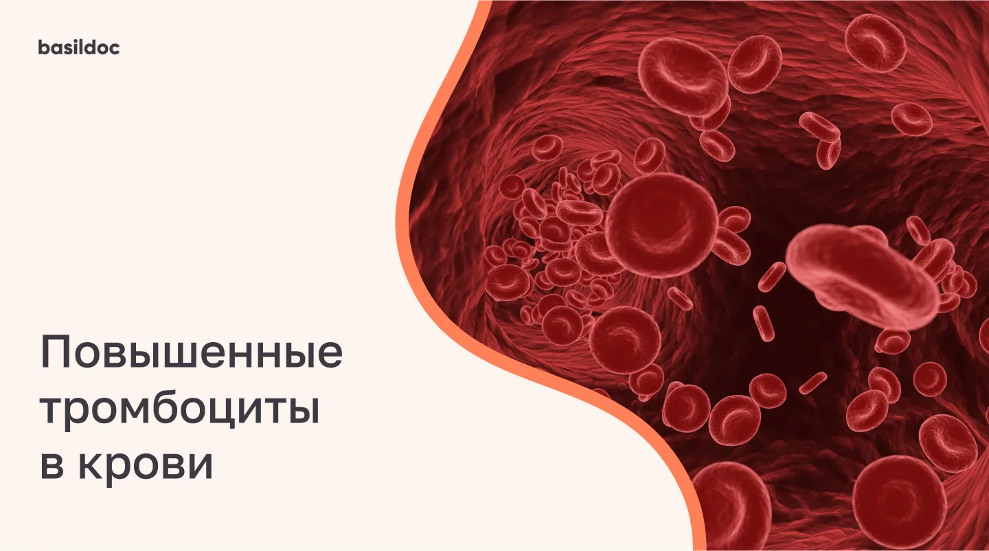 Почему повышены тромбоциты в крови и чем это чревато?